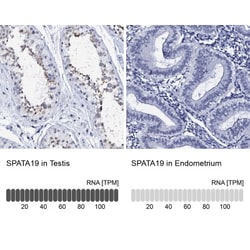 SPATA19 Antibody, Novus Biologicals 0.1mL; Unlabeled:Antibodies, Polyclonal